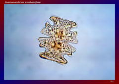 Euastrum moebii var. tetrachastriforme (Nord Australien, Mine Valley)-L 104, B 98