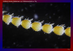 Gelbhals-Termite (Kalotermes  sp.)-Fühlerausschnitt-ca. 70x