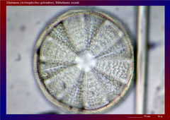 Diatomee (Actinoptychus splendens), ca. 600x 