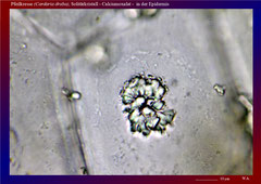 Pfeilkresse (Cardaria draba), Solitärkristall - Calciumoxalat -  in der Epidermis-ca. 600x