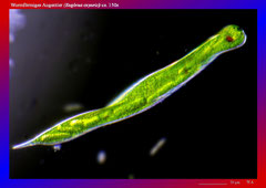 Wurmförmiges Augentier (Euglena oxyuris)-ca. 150x