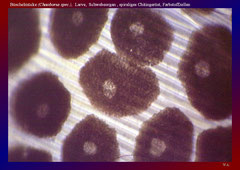Büschelmücke (Chaoborus spec.), Larve, Schwebeorgan , spiraliges Chitingerüst, Farbstoffzellen-ca. 600x