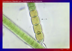 Cyanobakterium (Tolypothrix spec.), Verzweigung mit vier Heterocysten-ca. 600x