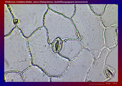 Pfeilkresse (Cardaria draba), untere Blattepidermis, Spaltöffnungsapparat (anisocytisch)-ca. 300x