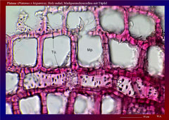 Platane (Platanus x hispanica), Holz radial, Markparenchymzellen mit Tüpfel - ca. 300x - Hp