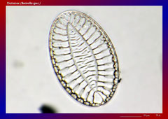 Diatomee (Surirella spec.)-ca. 300x