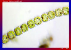 Diatomee (Melosira moniliformis)-ca. 300x