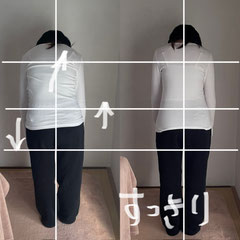 顎の痛み(20代女性)