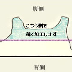 横2分割腹側