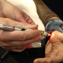   Laserbehandlung nach Puls-Schreibung