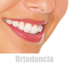 Ortodoncia