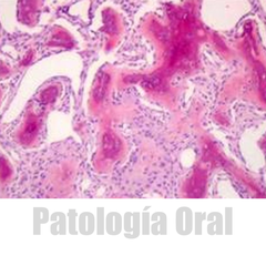 Patología Bucal