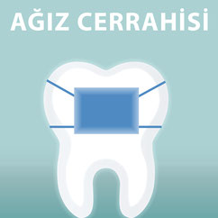 Oralchirurgie Die Zahnkünstler Hannover 