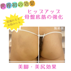 美脚・美尻効果　ビフォーアフター