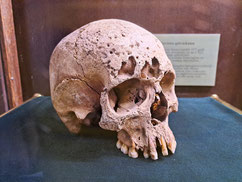 Human skull exhumed from a mass grave of executed witches in southern Latvia, on display in the Jelgvava Museum of Art and History