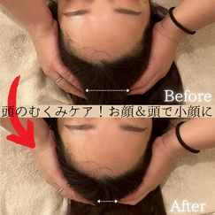 脳内洗浄　ビフォーアフター