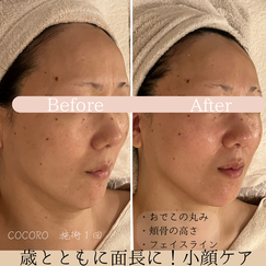 頭のむくみケア　ビフォーアフター