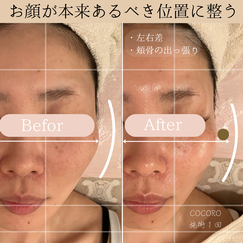 小顔ケア　ビフォーアフター