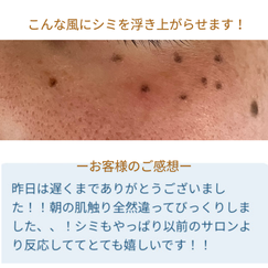 シミケア　口コミ