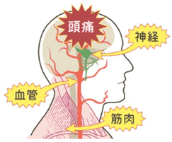 頭痛、神経、血管、筋肉　図解