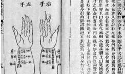 Illustration aus der TCM, die auch von Gottlieb Olpp reproduziert wurde. Quelle: Wellcome Images (https://wellcomecollection.org/works/qnw696wh (20.01.2023), Lizenz CC0.