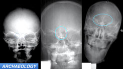 Anthropologists Devise New Technique for Estimating Juvenile Age at Death