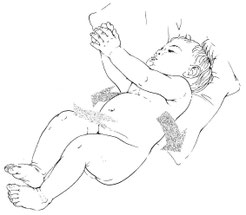 Fig. 2.5 - La respiration de l'enfant pendant son sommeil