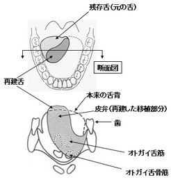 図１　私の舌の状態