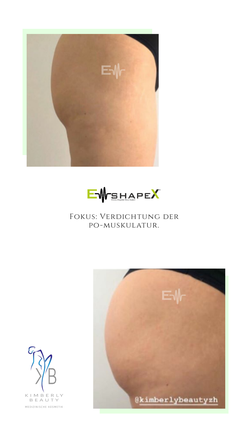 Wie häufig EMS machen?