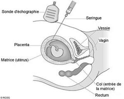 voie abdominale