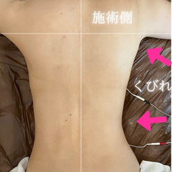 美脚・美尻効果　ビフォーアフター