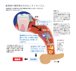 歯周病と糖尿病