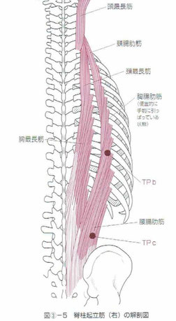 腰腸肋筋のトリガーポイント