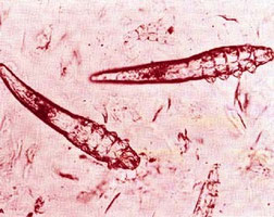 Die DEMODEX-Milbe
