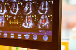 Bild: Ultraschall