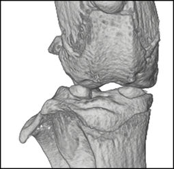 Mouse knee by microCT