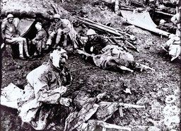 Blessés attendant d'être évacués vers l'arrière (Verdun, 1916)