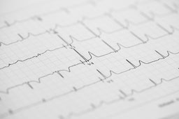 EKG