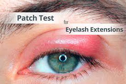 patch test, allergy, mobile beauty, beauty treatment, allergy testing, product safety, mobile beauty by lidiya,