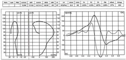 Grafik 4