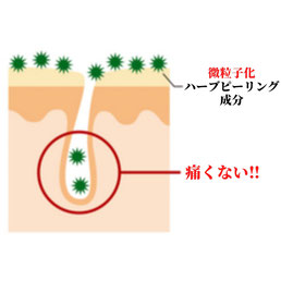 微粒子化したハーブピーリングパウダーのため、痛みほとんどありません。