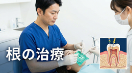 根の治療　神経の治療　精密　拡大視野