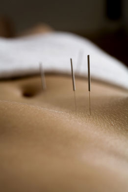Behandlung des Körpers mittels Akupunktur