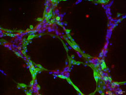 血管内皮細胞と骨髄間質細胞がつくる管腔ネットワーク