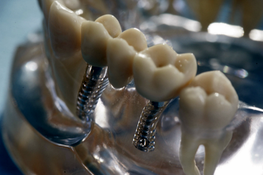 Implantate