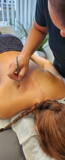 Akupunktur Basel, Physiotherapie Basel, Willi Penzel, APM, Massage Basel, Akupunkturmassage, Energie Basel, Hilfe bei Schmerzen Basel