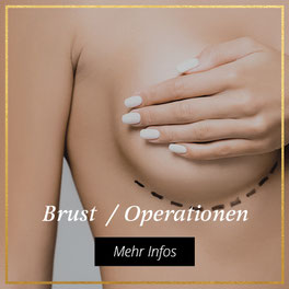 Brust Operationen bei Bargello AESTHETIK in Giessen
