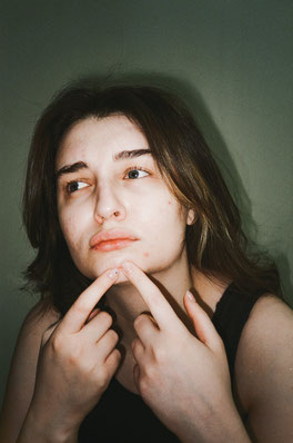 androgènes chez la femme