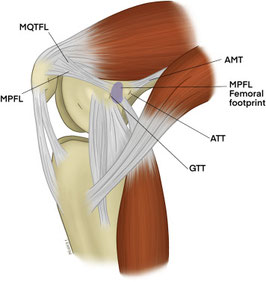 MPFL：内側膝蓋大腿靭帯