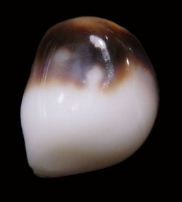Strombus  lentiginosus  ,strombus pearl 8.7mm wild natural pearl